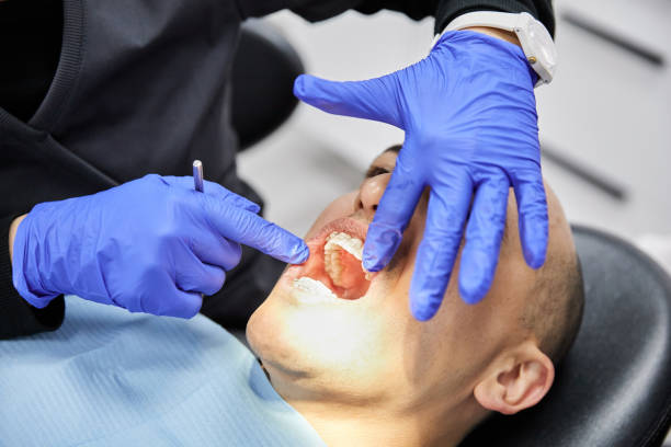 Best Emergency Tooth Extraction in Waterloo, IL